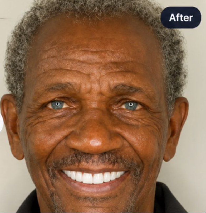 After dental smile preview